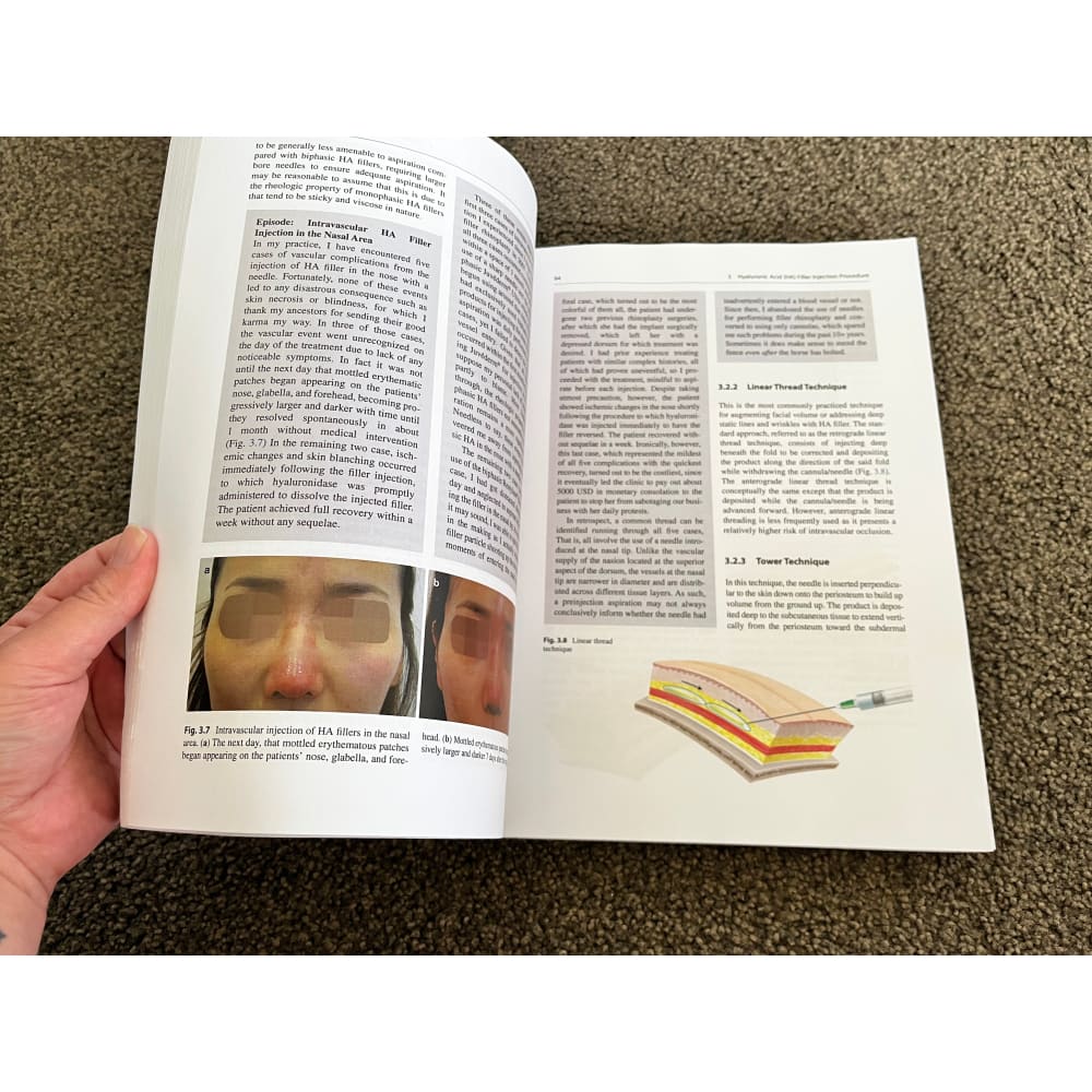 Facial volumization with fillers by kyle k. Seo - books condition: used printed media