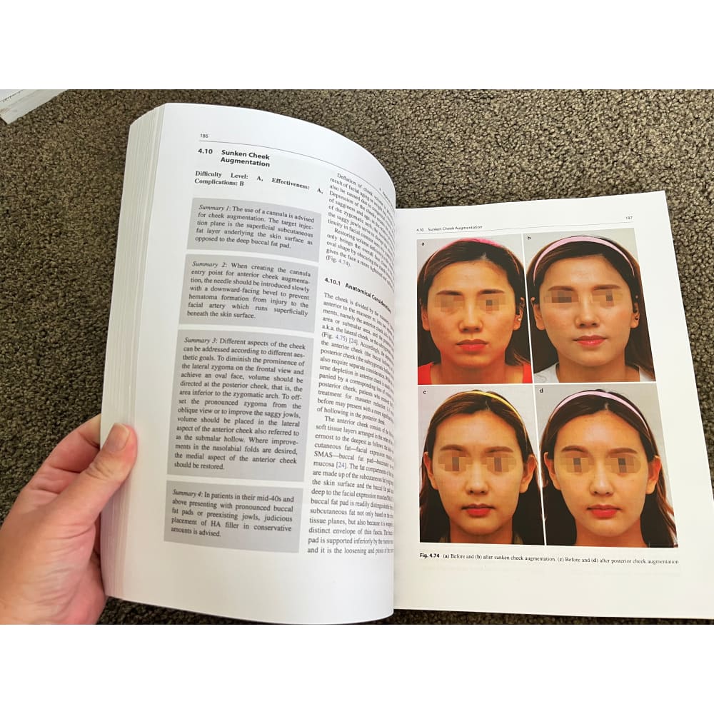Facial volumization with fillers by kyle k. Seo - books condition: used printed media