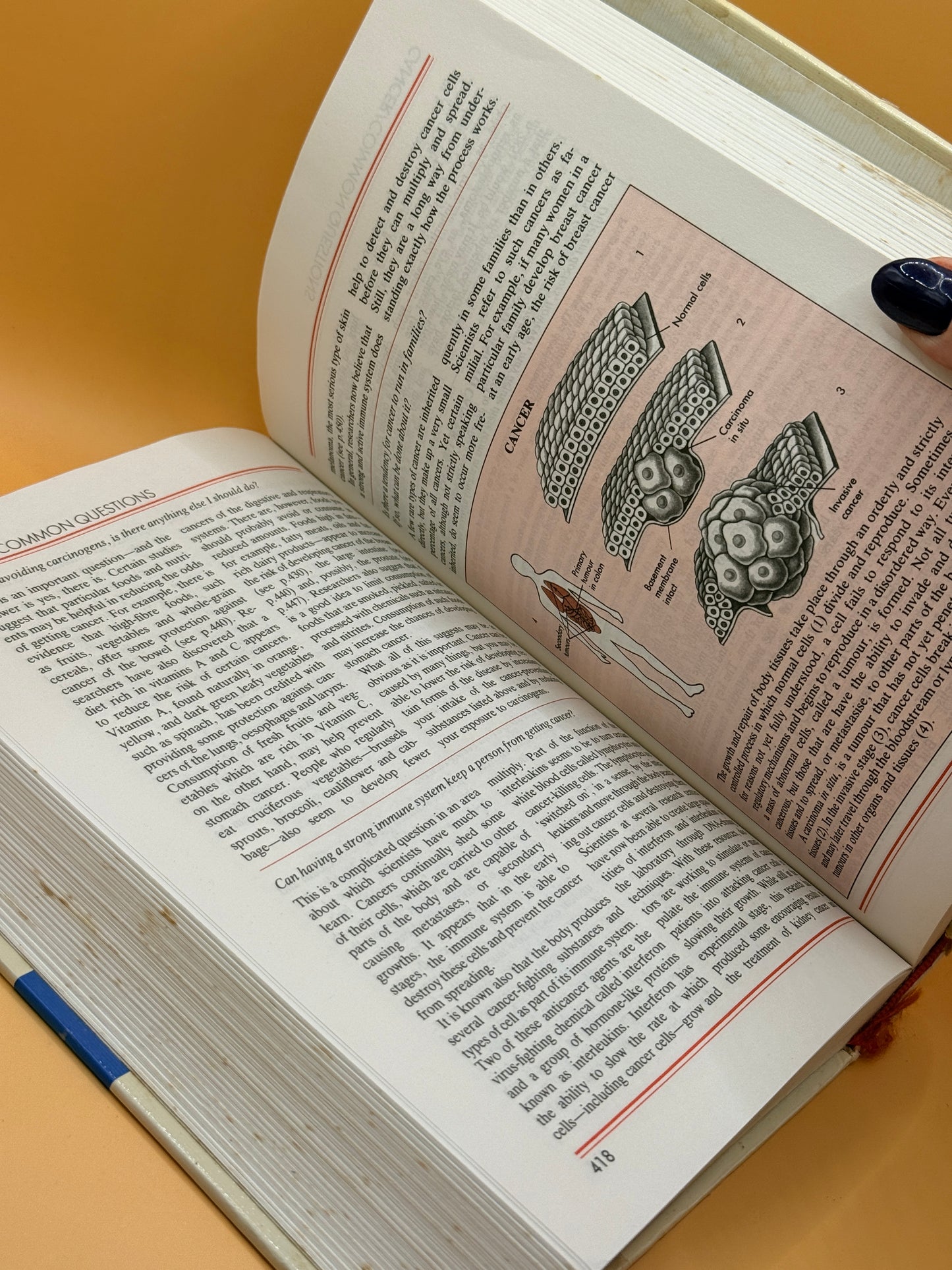 The Reader's Digest Medical Question & Answer Book by Reader's Digest