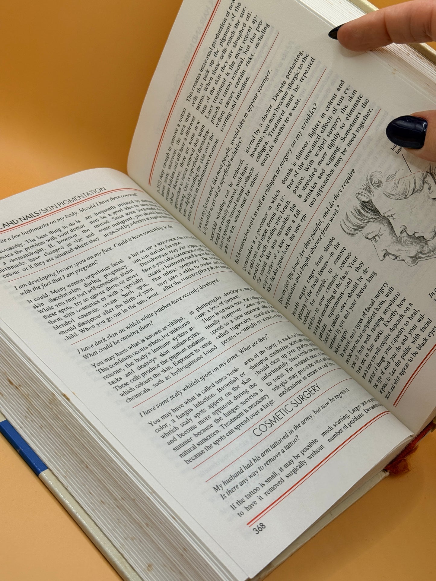 The Reader's Digest Medical Question & Answer Book by Reader's Digest