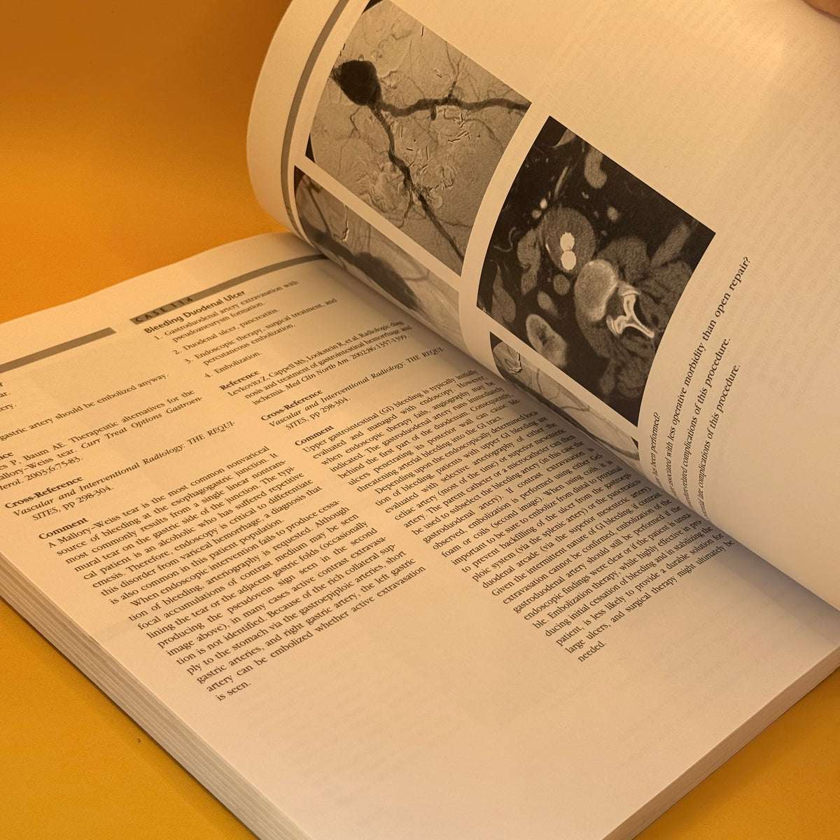 Vascular and Interventional Imaging: Case Review Series, Second Edition